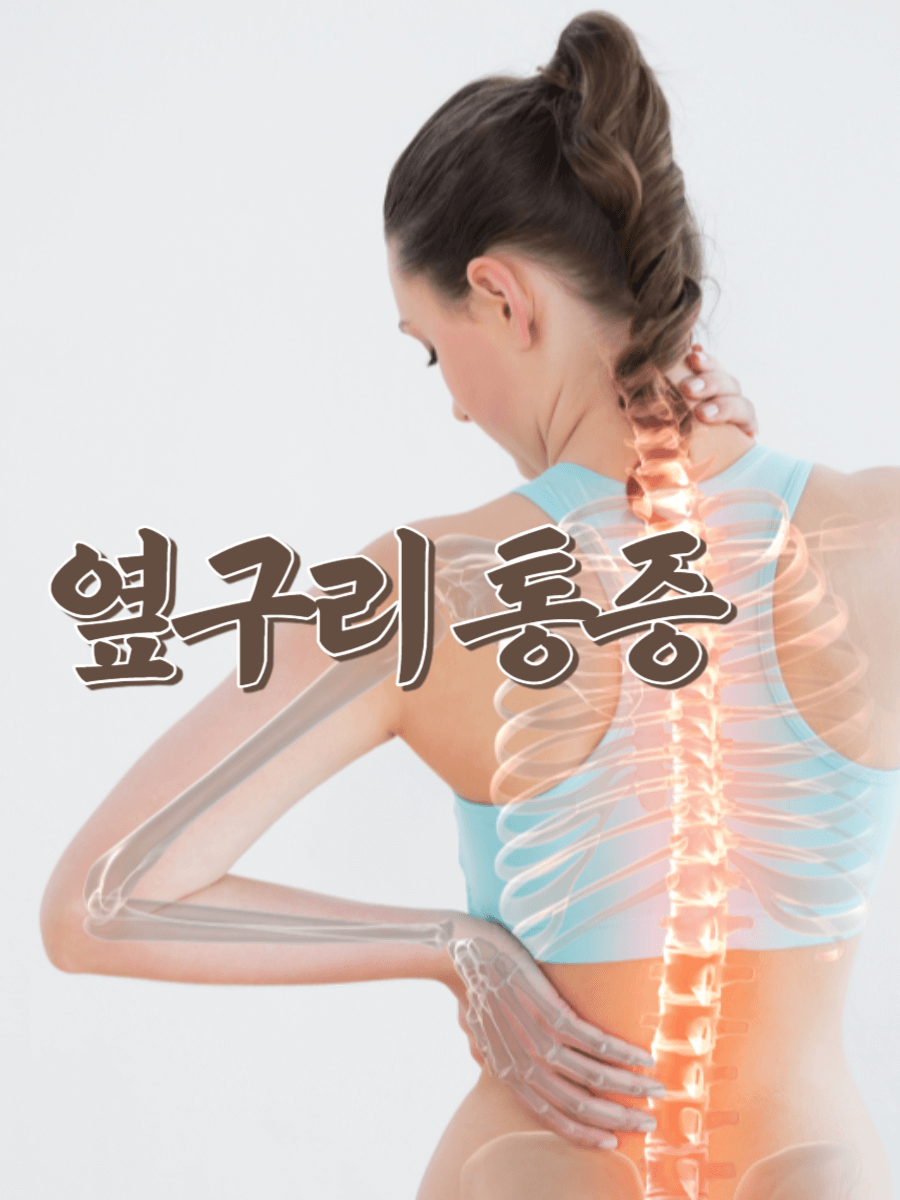 옆구리 통증의 다양한 원인(flank pain has many causes) 1 flank-pain