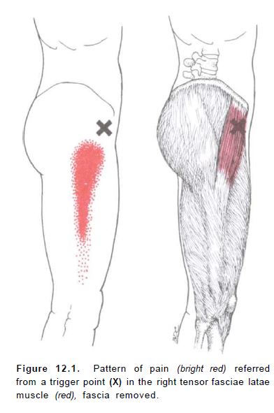 travell and simons trigger point referral patterns adductor