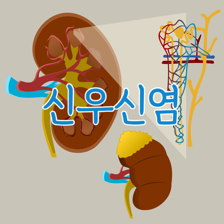 강한 옆구리 통증의 신우신염: 몸살로 착각할 수 있어요! 1 신우신염