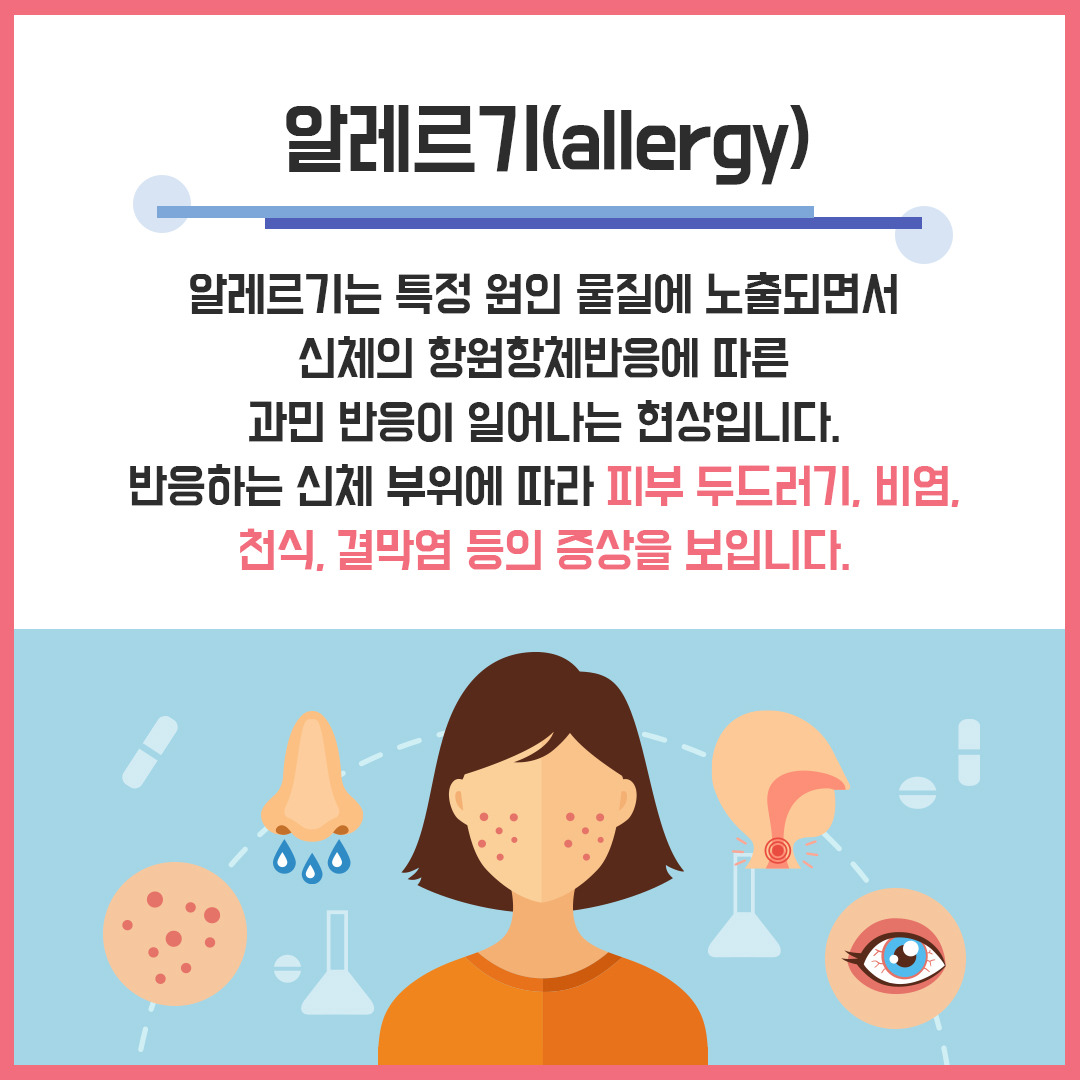 알레르기 질환 주요 원인 ‘식품’