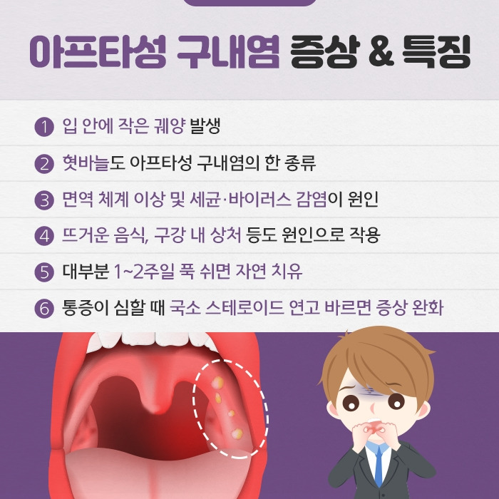 휴가 뒤 찾아온 입병 ‘구내염’ 종류 & 개선법