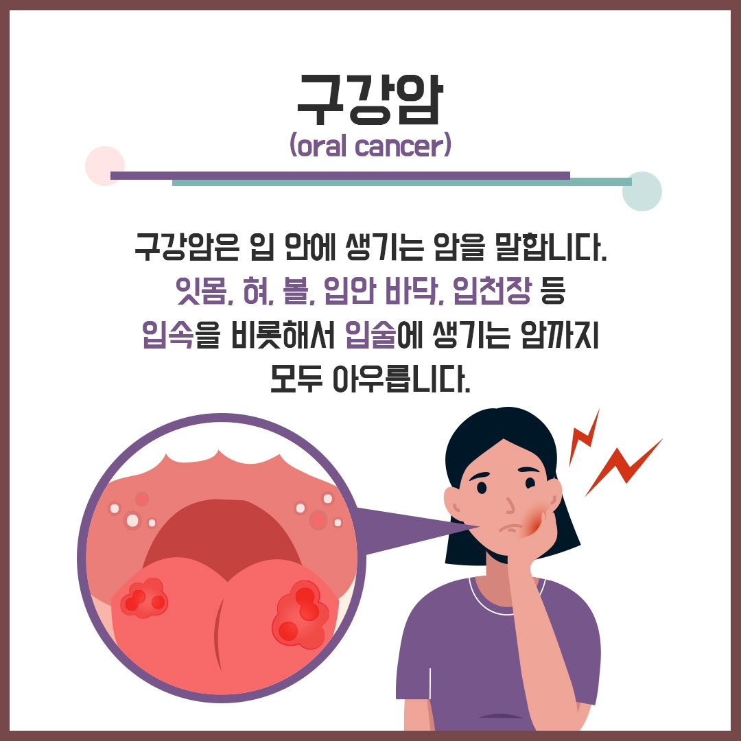 입 속 상처가 오래가네...
