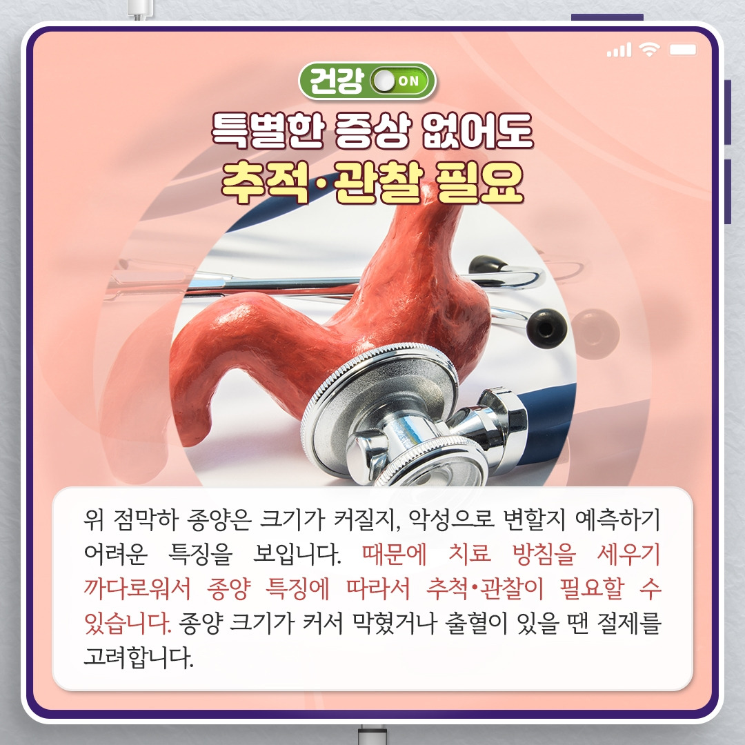 위내시경이 찾은 ‘위 점막하 종양’