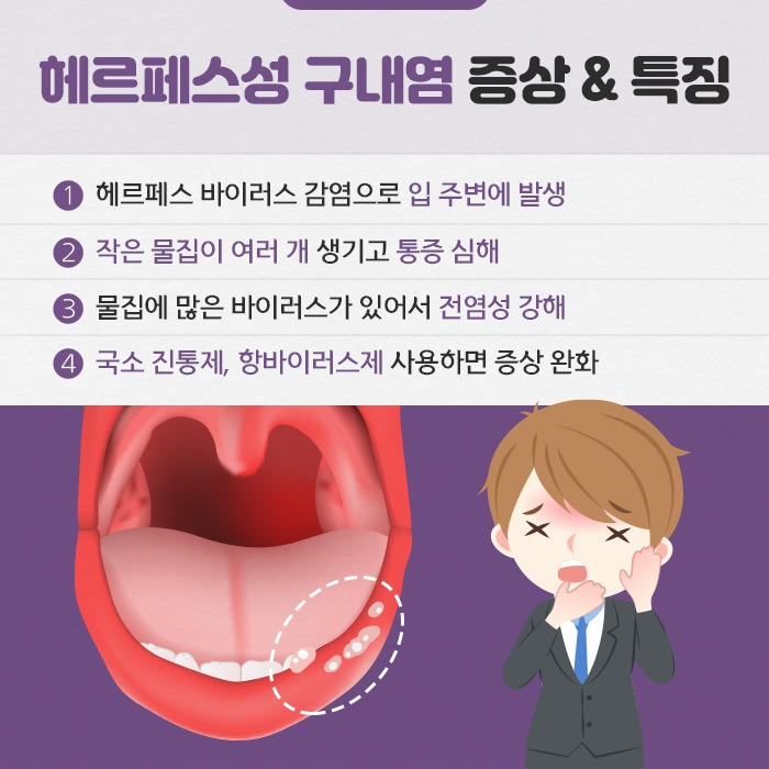 휴가 뒤 찾아온 입병 ‘구내염’ 종류 & 개선법