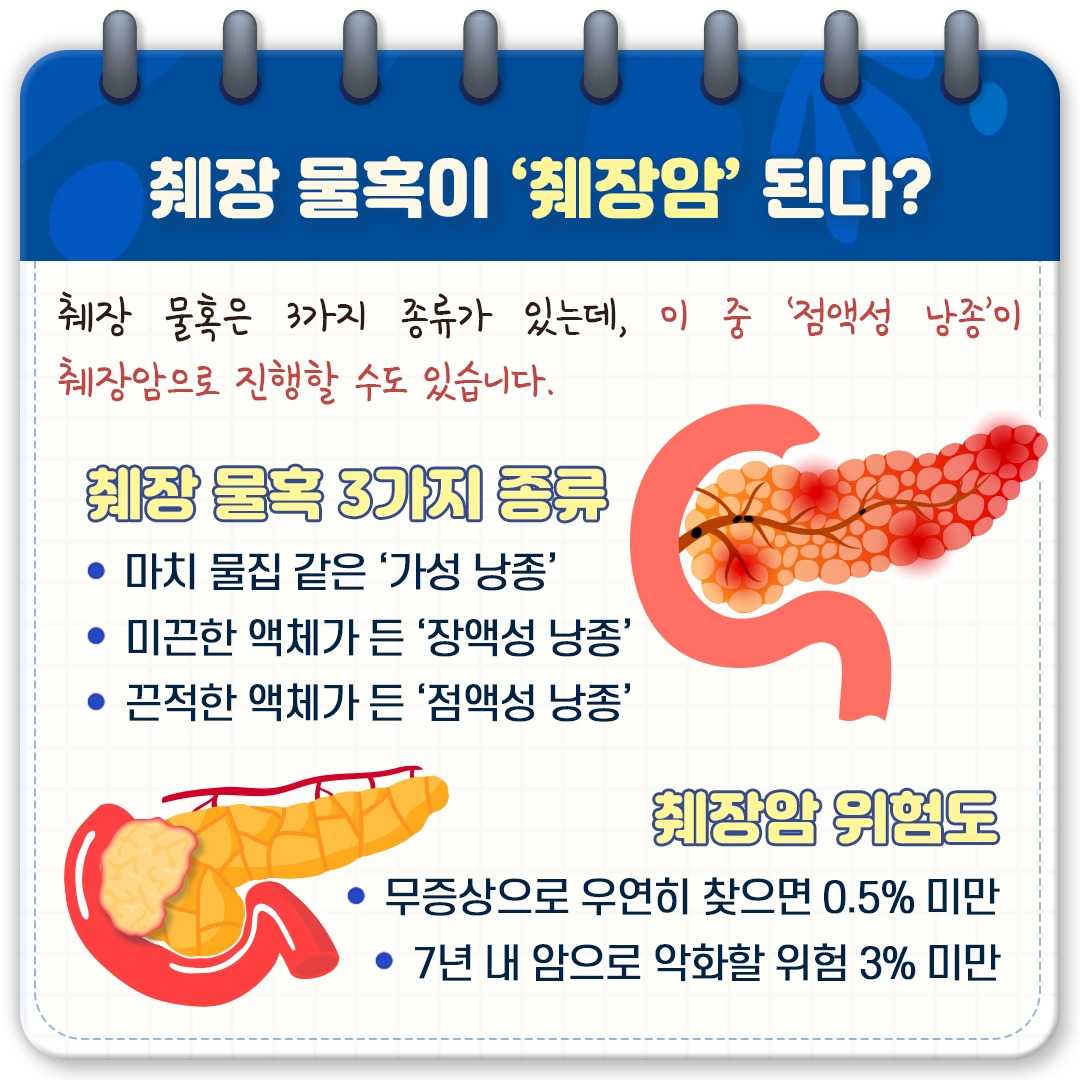 건강검진에서 찾은 ‘췌장 물혹’