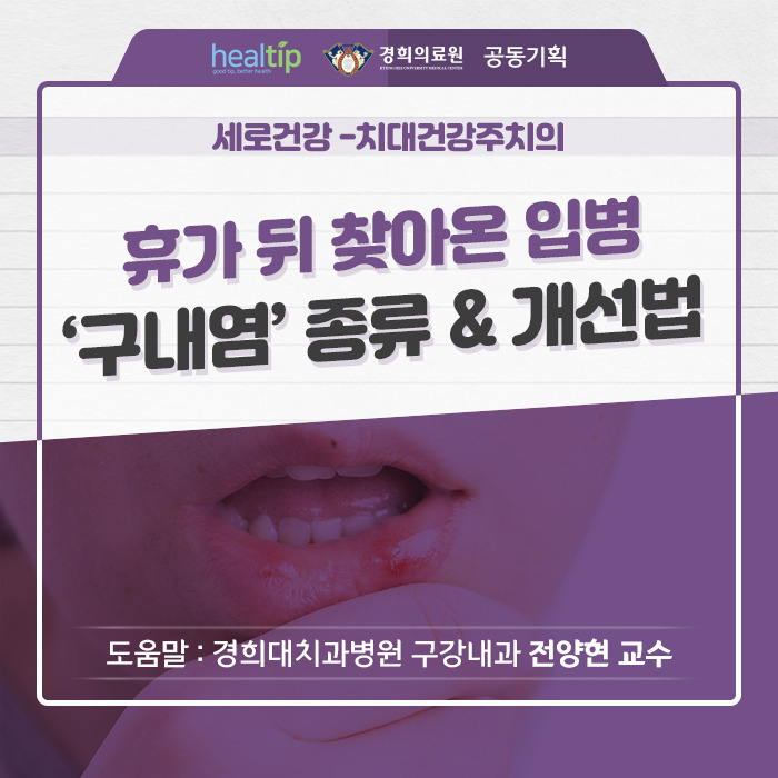 휴가 뒤 찾아온 입병 ‘구내염’ 종류 & 개선법