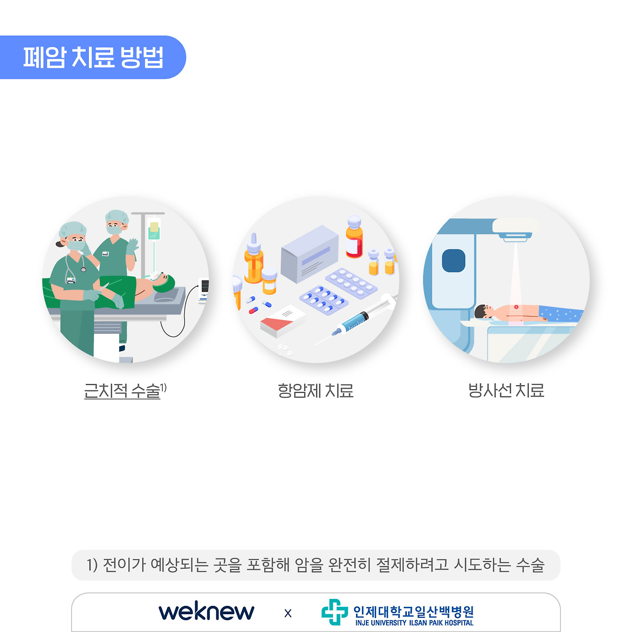 폐암 원인과 진단방법