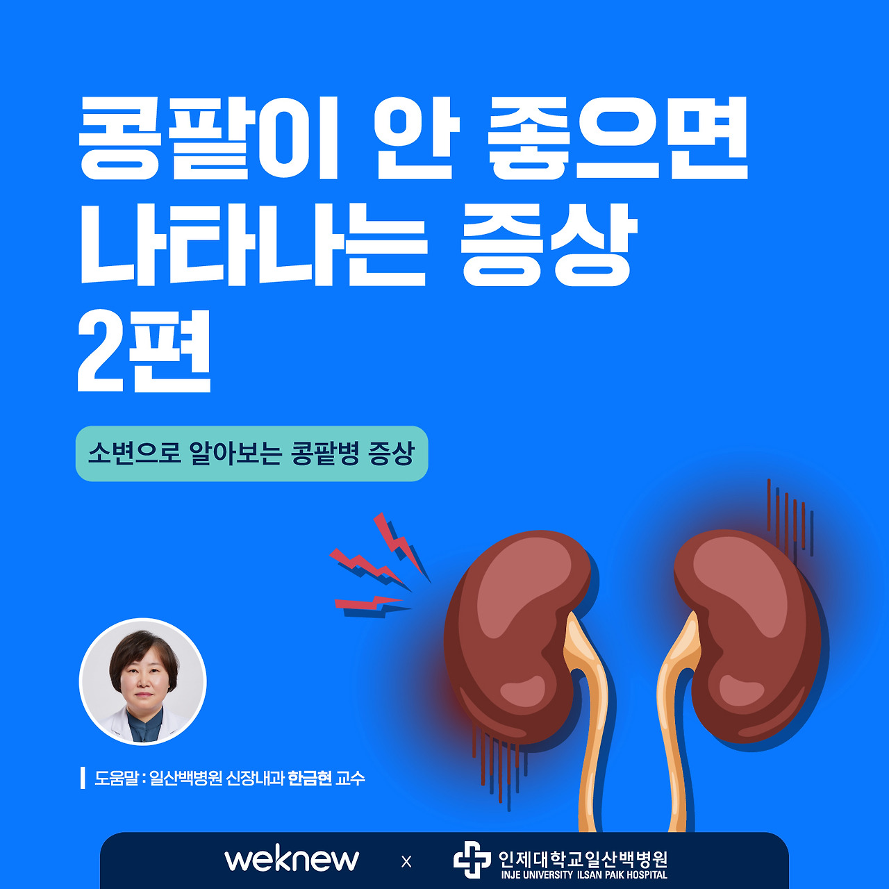 신장 문제의 10가지 증상