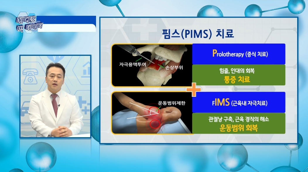 어깨 석회성건염 치료 수술하지 않는