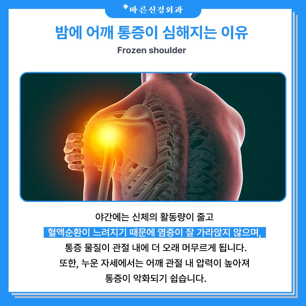 누우면 어깨가 아프다? 야간 어깨 통증 원인과 치료