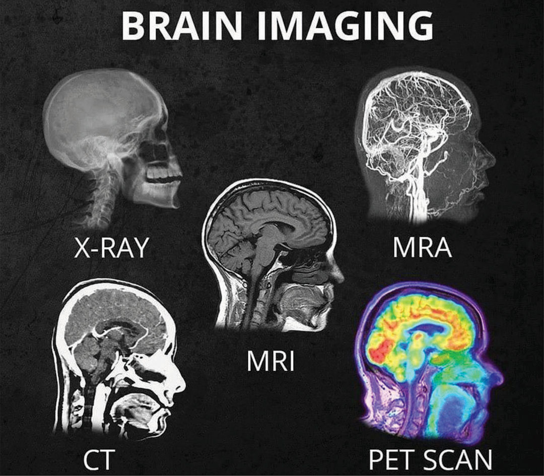 ct-mri