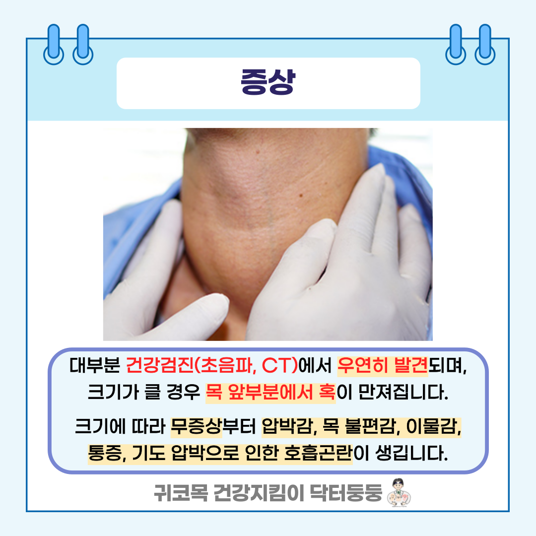 갑상선 결절 및 갑상선 낭종 때문에 면역력 케어가 필요한 경우