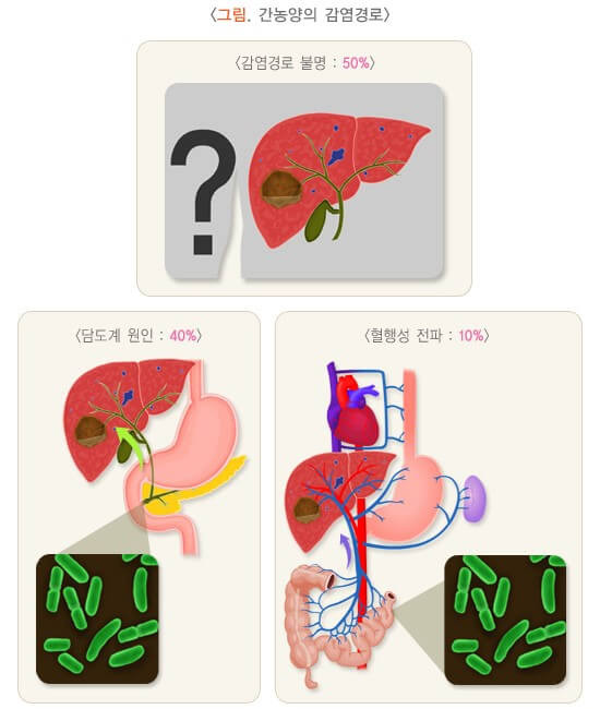 몸살인 줄 알았는데 간에 고름이 생겼어요: 간 농양 3 ywAAAAAAQABAAACAUwAOw==