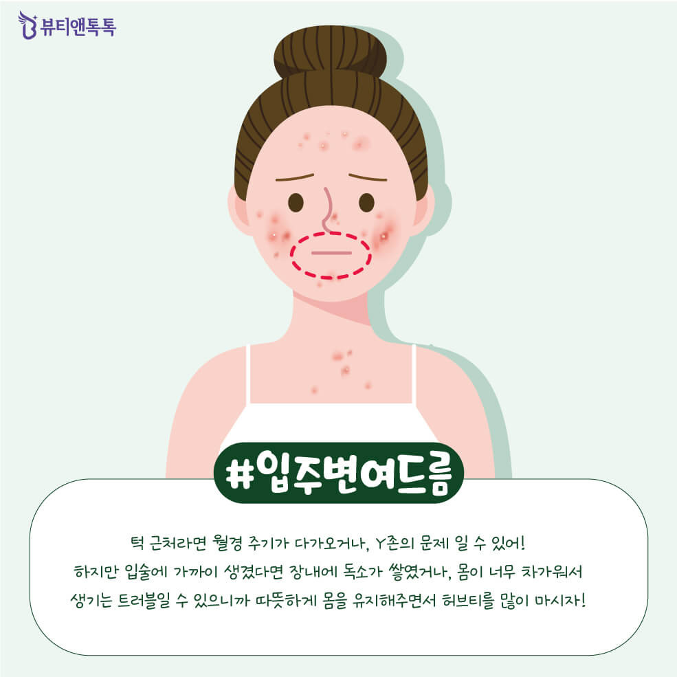 Các phương pháp phòng ngừa mụn trứng cá theo từng vùng da