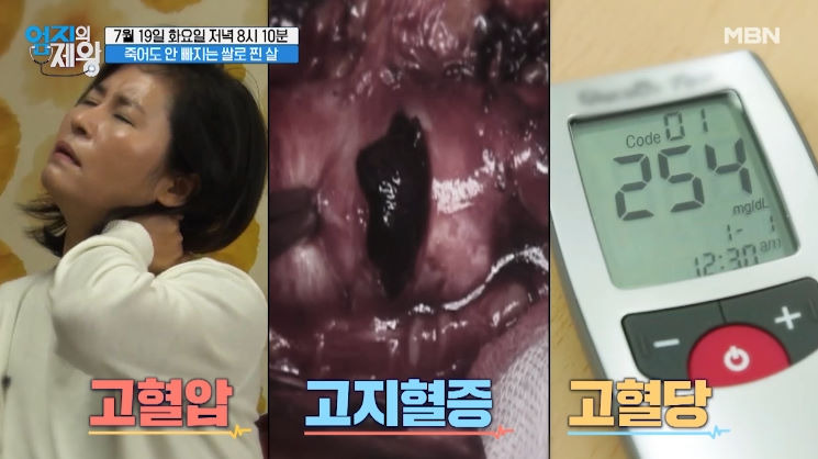 엄지의제왕 마늘찹쌀밥 레시피 살빠지는잡곡 현미찹쌀의 비밀 2 ywAAAAAAQABAAACAUwAOw==