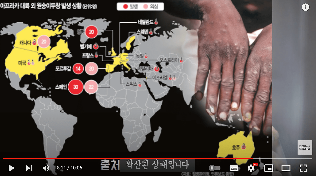 원숭이 두창에 대한 합리적인 의심(ft.전인구경제연구소) 4 전세계의 원숭이 두창 발생상황