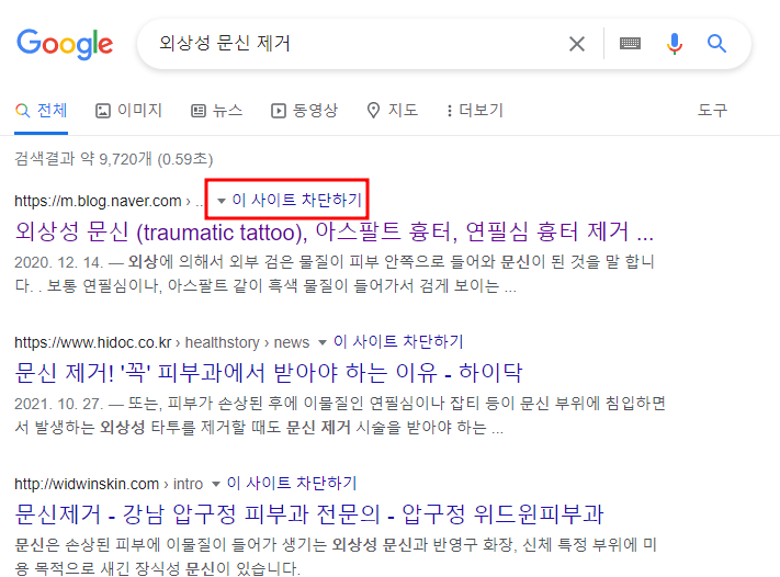 구글 검색 꿀팁: 정보 가치가 없는 사이트 검색되지 않도록 차단하기 (유해, 광고,쓸모없는 블로그) 5 ywAAAAAAQABAAACAUwAOw==