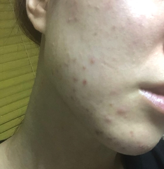 내 피부타입(건성, 중성,지성)은 무엇이며 종류는? 3 ywAAAAAAQABAAACAUwAOw==