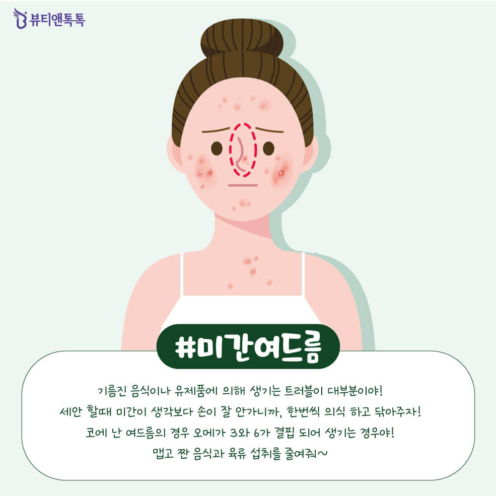 Các phương pháp phòng ngừa mụn trứng cá theo từng vùng da