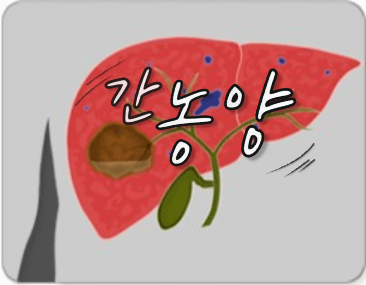 몸살인 줄 알았는데 간에 고름이 생겼어요: 간 농양 1 ywAAAAAAQABAAACAUwAOw==