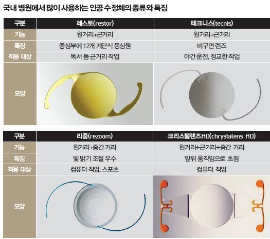노안 백내장 수술 비용을 결정하는 인공수정체 단초점 인공수정체의 장점 10