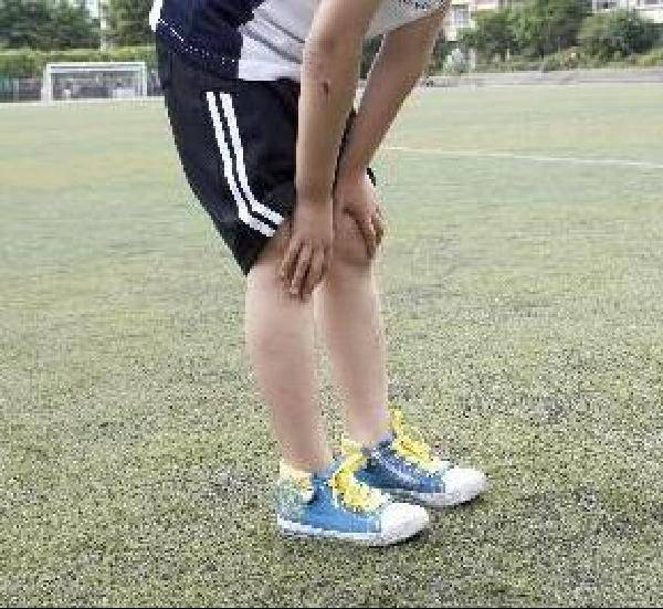 [헬스조선]오스굿씨병은 주로 성장기에 나타나는 증상으로 무릎을 굽히는 역할을 하는 허벅지 대퇴사두근 부위 정강이뼈가 반복적으로 당겨져 염증이 생기는 질환이다/사진=조선일보 DB
