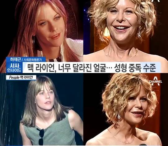 멕 라이언 근황 성형 중독설