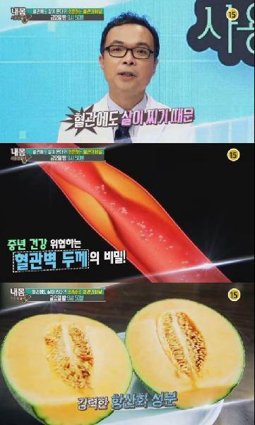 [헬스조선]TV조선 <내 몸 사용설명서>에서는 혈관 건강의 비밀에 대해 알려준다/TV조선 제공