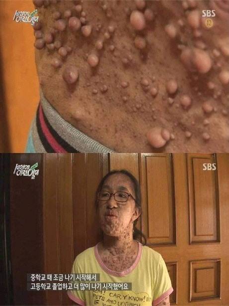 <세상에 이런 일이> 이아경씨. 사진 SBS 화면 갈무리