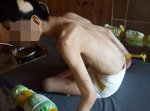 해당 병원의 입원 병동 환자 모습.  [독자 제공=연합뉴스]