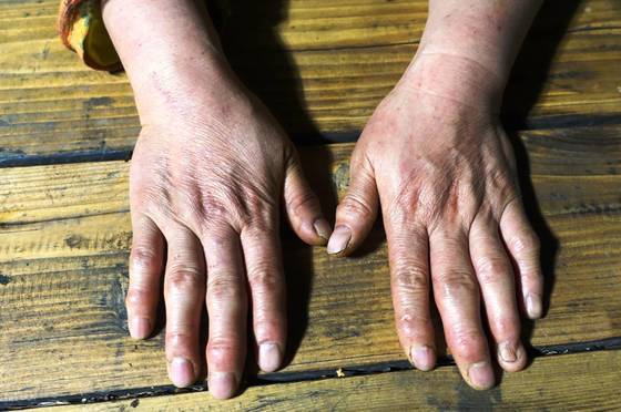 안주인 안정숙씨 손은 결혼 후 36년 동안 쉬지 않고 해온 일이 골수에 사무쳐 성한 곳이 별로 없다. 사진을 찍으려 하자 부끄럽다며 뒤로 감췄다. 보기엔 가슴 아팠지만 부러울 것 없는 살림을 일군 주역이니 자랑스러워 하시라고 설득했다.