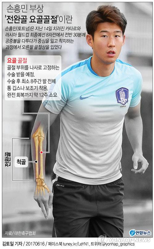 [그래픽]  손흥민 부상 '전완골 요골골절'이란        (서울=연합뉴스) 김토일 기자 = 러시아 월드컵 최종예선 카타르전에서 다친 한국 축구대표팀의 에이스 손흥민(토트넘)의 정확한 진단명은 오른팔 '전완골부 요골 골절'이다.      kmtoil@yna.co.kr      페이스북 tuney.kr/LeYN1 트위터 @yonhap_graphics