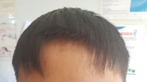 지난 6월 경북의 ㄱ중학교에서 한 교사가 규정에 어긋난다며 학생 5명의 머리카락을 강제로 잘랐다. 사진은 앞머리가 잘린 학생들의 모습. 사진 인권친화적학교+너머운동본부 제공.