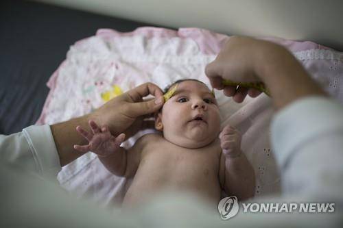 브라질의 소두증 신생아(AP=연합뉴스 자료사진)