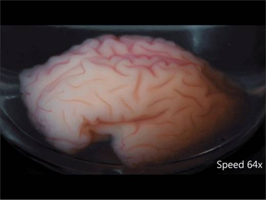 특수 젤 소재로 만든 뇌 입체 모형