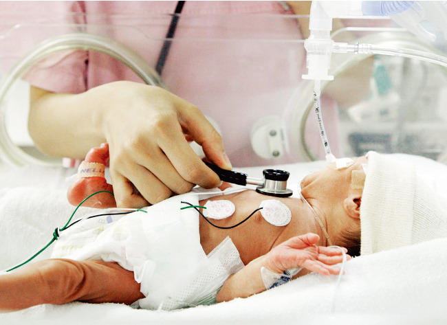 출생 후 치료를 받고 있는 신생아. 산모가 고령일수록 아기와 산모가 각종 질병에 노출될 위험이 높기 때문에 좀 더 전문적인 진료와 처치가 필요하다. [동아DB]