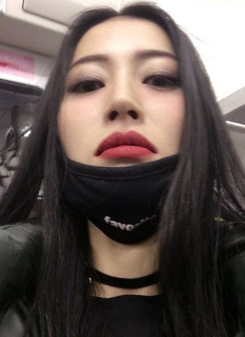 황보 성형 해명