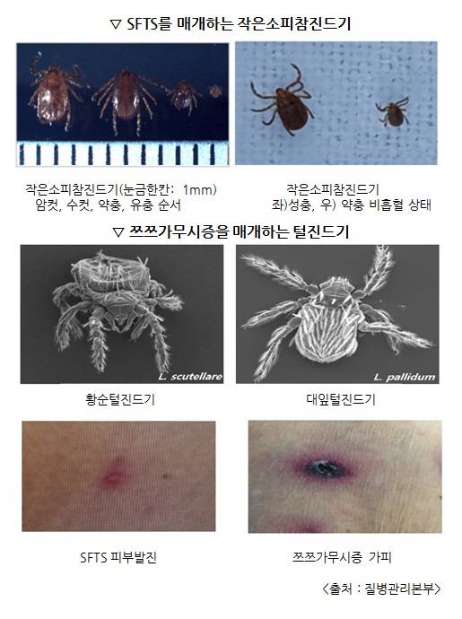 SFTS를 매개하는 작은 소피참진드기/쯔쯔가무시증을 매개하는 털진드기