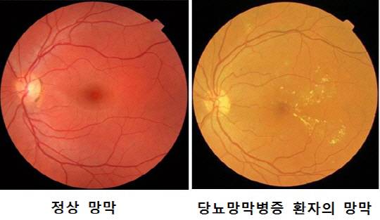 사진제공=분당서울대병원
