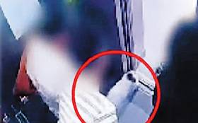 지난달 30일 오전 서울 강남구의 한 아파트 엘리베이터에서 유명 한식당 대표 김모(53)씨가 목줄이 풀린 프렌치 불도그(동그라미 안)에게 물려 움찔하는 모습. 김씨는 병원 치료를 받았으나 엿새 뒤 패혈증으로 사망했다. /SBS 캡처