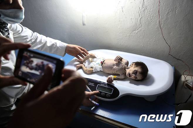 시리아 의료진이 '사하르'의 몸무게를 재고 있다. © AFP=뉴스1