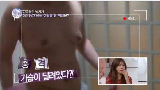 클라인펠터증후군. 사진=tvN '렛미인3' 캡처