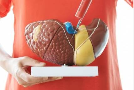 간을 건강하게 유지하기 위해서는 지나친 음주를 삼가고 비만해지지 않도록 관리해야 한다. 사진-헬스조선DB