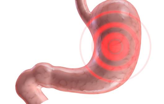 위내시경 검사와 위용종