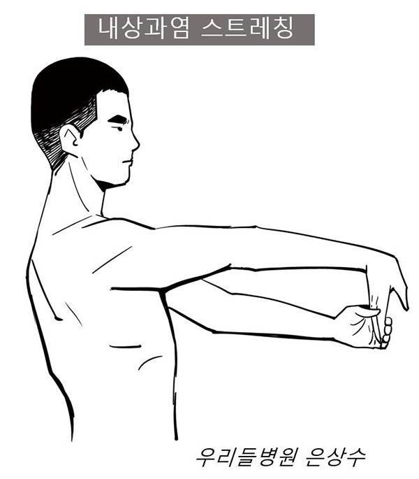 내상과염 스트레칭 / 사진-은상수 전문의 제공