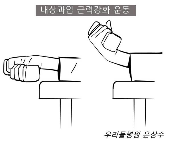 팔꿈치 밴드 착용 방법 / 사진-은상수 전문의 제공