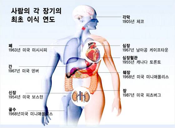 장기이식수술의 역사 [사진=과학창의재단]