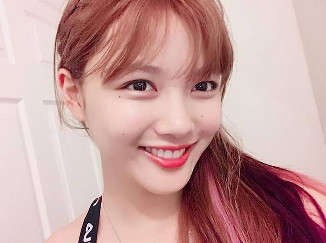 사진=배우 김유정이 갑상선 기능 저하증 투병 사실을 알렸다.