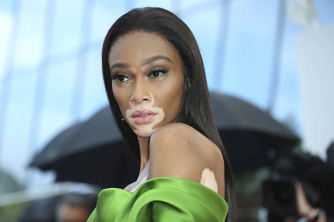 사진기자들을 위해 자신있게 포즈를 취하는 위니 할로우. [AP=연합뉴스]