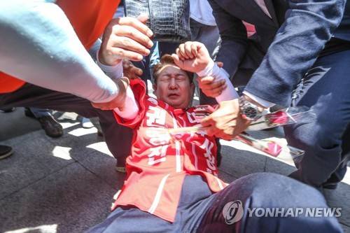 넘어지는 권영진 후보 (대구=연합뉴스) 자유한국당 권영진 대구시장 후보가 31일 오후 대구시 중구 반월당 유세현장에서 넘어져 다치고 있다. 2018.5.31 [경북일보 제공=연합뉴스]  photo@yna.co.kr
